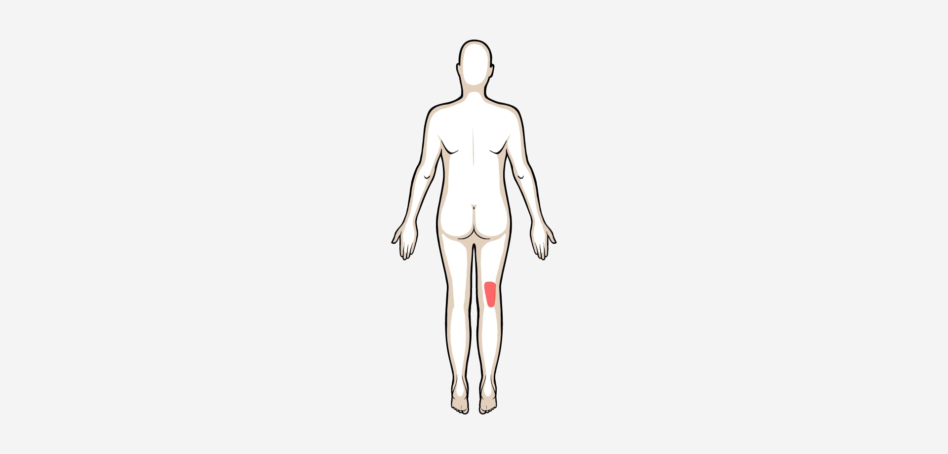 Dolor posterior del muslo